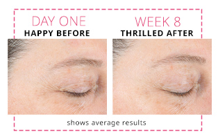 Before and after images showing average improvement to the extended crow’s-feet area after eight weeks of using Dynamic Wrinkle Limiter
